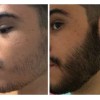 Crecer La Barba Bigote Cejas Profesional Y Natural Novocrin