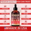 Vitboost Complejo B Vitamina B12 Liquida Hecho En Usa