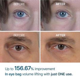 Dr.Melaxin Eyephalt Eyebag Cream for puffiness, dark circles, wrinkles