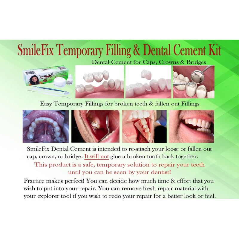 SmileFix Filling, Cap, Crown & Bridge Dental Repair Kit -