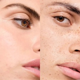 Srum facial antiacn de doble correccin Normaderm, 50 g, Vichy, da y noche, piel grasa                                                                 