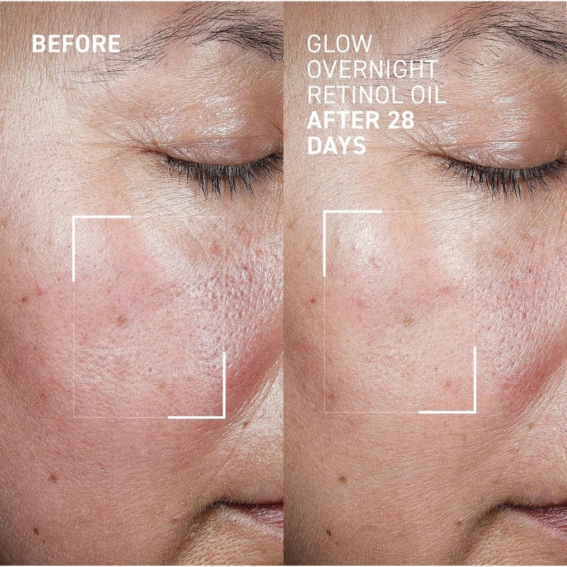 Glow Overnight Retinol Oil by Dr. Brandt for Women -