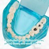 LVCHEN - Modelo de dientes de implante dental transparente, modelo