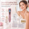 Professional Plasma Beauty Pen for Cosmetic Spot Care – 9-Level