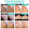 Tattoo Cover Up Makeup, 2-Colour Tattoo Cover, Waterproof