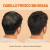 Shampoo Sin Sal Shampoo Hombre Control De Grasa Profesional