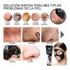 🔥 Máscara removedora de puntos negros loveyes 100ml tipo de