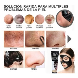 🔥 Máscara removedora de puntos negros loveyes 100ml tipo de piel normal  Vitaminas y Minerales
