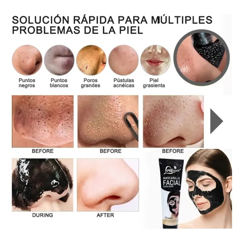 🔥 Máscara removedora de puntos negros loveyes 100ml tipo de