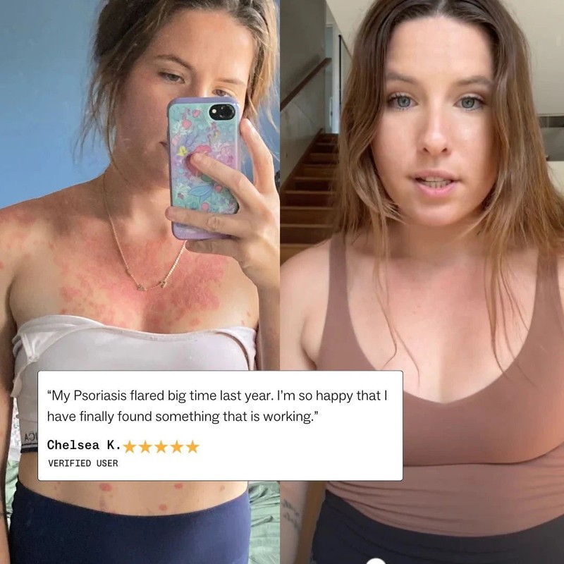 My Way Up Complete Skin Clear System Bundle