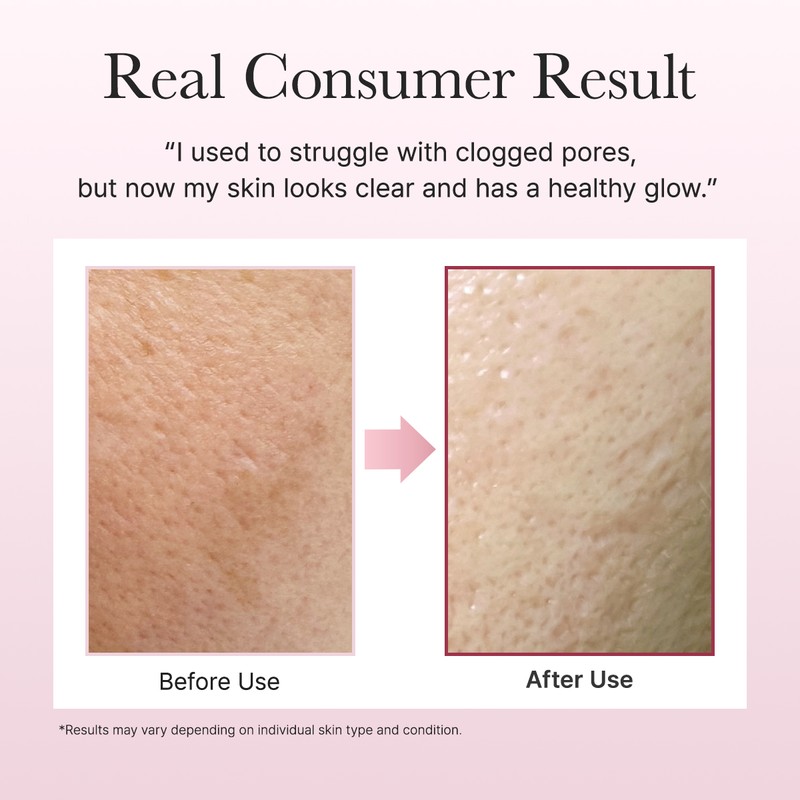 ARENCIA [ARENCIA]*renew* Fresh Rosehip Rice Mochi Cleanser 120g