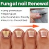 Ginger Nail, Tratamiento de Uñas con Jengibre, Soporte para Uñas,