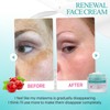 Skin Renewal Face Cream, Melasma Cream, Pigmentation Removal Cream For