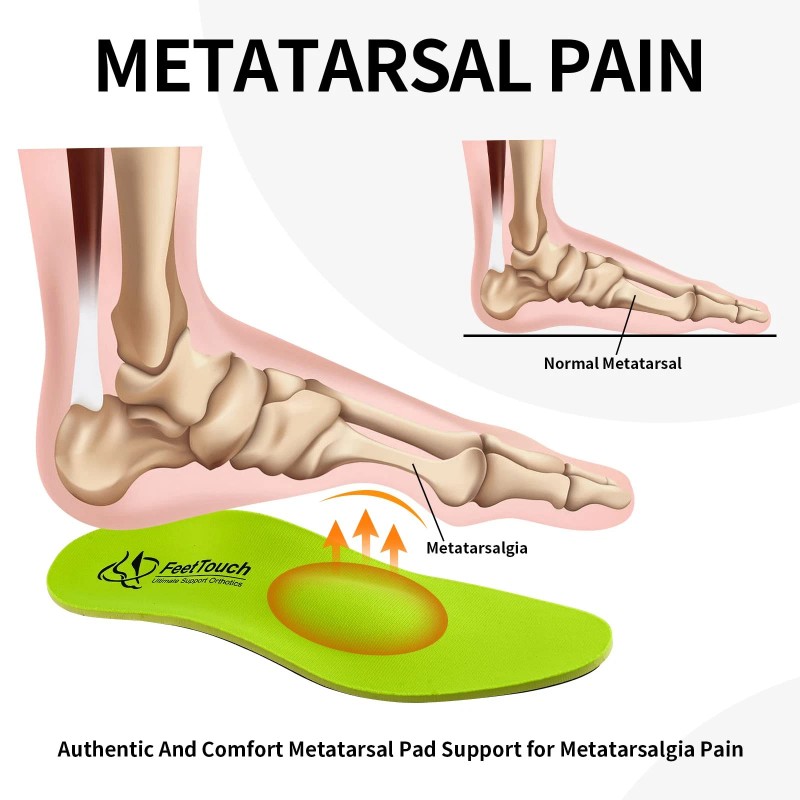 FEETTOUCH Strong Arch Support Orthotics for Metatarsalgia Morton's Neuroma Ball