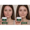 Crema Herbal Piel Con Imperfecciones Control Grasa Facial