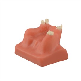 Ultrassist Dental Sinus Lifting & Implant Placement Practice Model B, Basic Implant Training Model with Practice Soft Gums, Great Dental Training Tooth for Dental Implant Practice