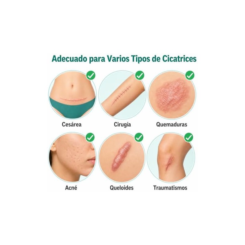 Parches Silicona para Cicatrices – Láminas Reutilizables para Cesárea y