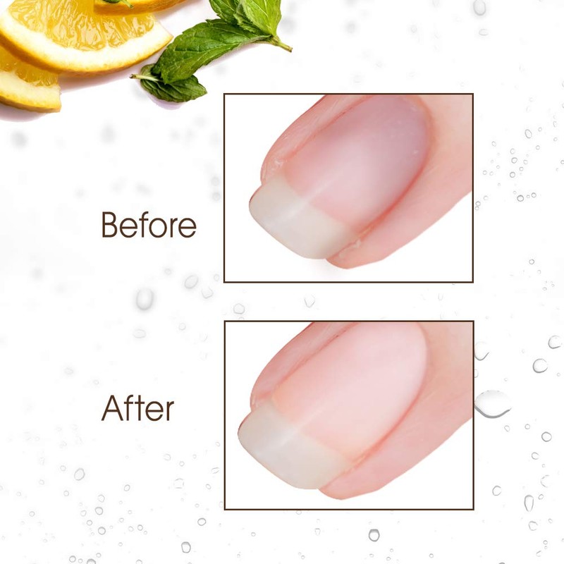 Gena Nail Brite Whitening Scrub with Brush, Cleans Conditions &