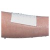 Rudafilm Sterile Wound Dressing 15 x 10 cm (Pack of