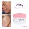 Akny Crema Para Eliminar Acné