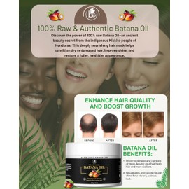 Batana Oil for Hair Growth – 100% Raw & Natural Hair Mask – 4.16 oz – Thickens & Strengthens – Moisturizes & Helps Repair Split Ends – For All Hair Types – by Bexpertsusa