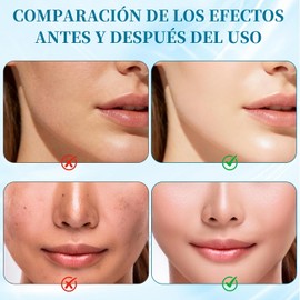 Crema Hidratante Centella Asiatica，hidratante facial，Cream Korean，hidratación profunda y reparadora，adecuada para todo tipo de piel,Mejora eficazmente las arrugas, las líneas de expresión y la piel seca.