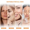 Water Peeling Hydrofacial Skincare Face Moisturizer Cleaning Skin Serum Aqua