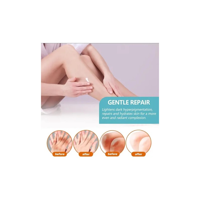 Crema Correctora Manchas Oscuras Hiperpigmentación, Vingtank