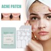 396Pcs Blemish Patches Facial Pimple Zit Spot Stickers Mild Non