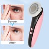 Electric Facial Massager Machine Colorful Light Vibration Face Skin Rejuvenation