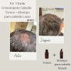 Paquete Tónico Y Shampoo Para Cabello Lacio Tónico Vittale