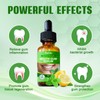 Gum Restore Drops-Bad Breath Treatment for Adults, Gum Regrowth Drops-Repair