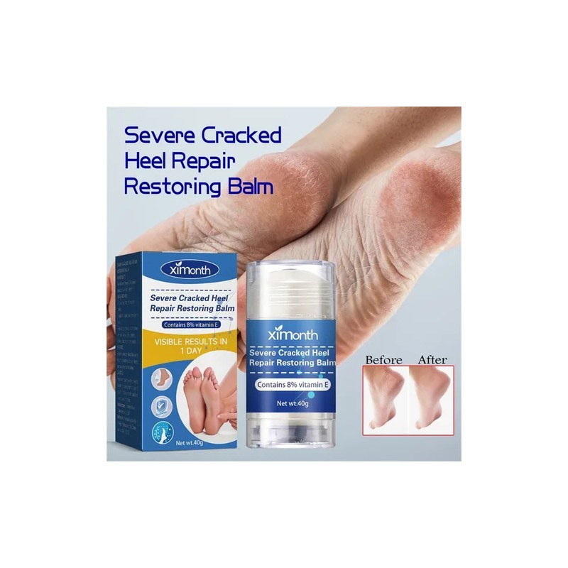 2×crema Reparadora Grietas Secas Y Talones For Pies Y Mano