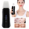 Face Skin Scrubber USB Rechargeable Peeling Machine Ultrasonic Exfoliating SkinCare(Black
