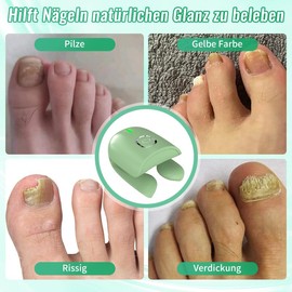 LaseLocks Nagelpilz Laser Behandlung Gerät, 905nm Infrarot Laser tötet Pilz in den Nägeln und tiefen Schichten der Haut, Wiederaufladbare tragbare Laser Therapie Gerät - grün