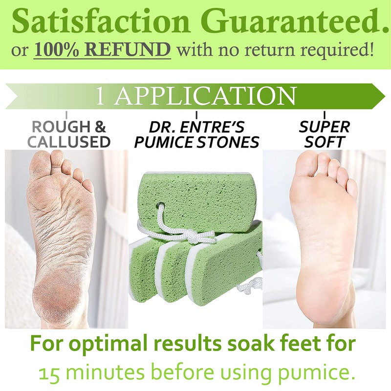Dr. Entre's Pumice Stone for Feet 4 Pack: Callus Remover,