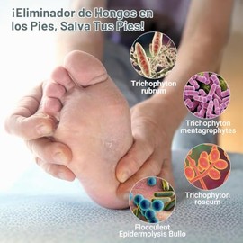 Tratamiento antifúngico de hongos para pies y dedos, suero de máxima fuerza con tolnaftato 1% – Solución de alivio de piel de hongos y pies de atleta 