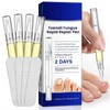 4Pcs Nail Care Pens, Moisturizing Nail Strengthener for Discoloured Nails