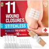 Emergency Wound Closure Strips - 11pk - 2 Types Easy