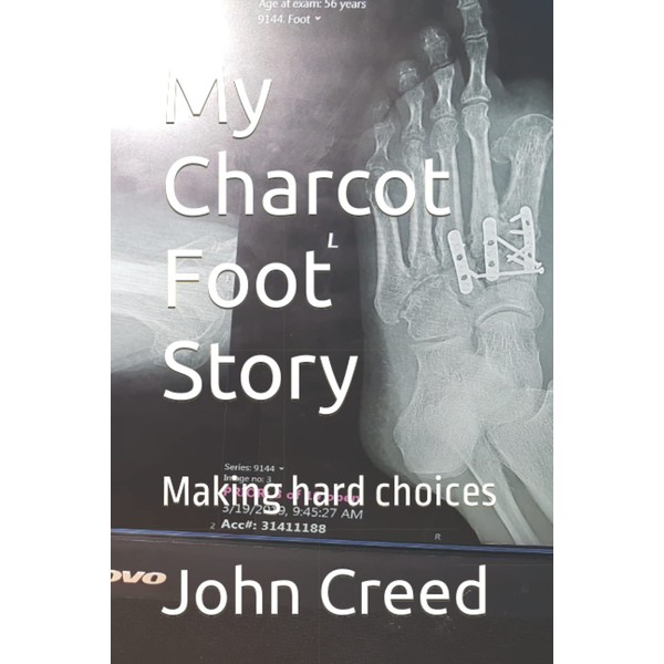 My Charcot Foot Story: Making hard choices