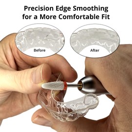 USB Aligner Retainer Polishing Tool – Portable Electric Mini Polisher Helps Refine Edges for a Comfortable Fit, Edge Smoothing and Surface Finishing – Polishing Head Set with Step-by-Step Instructions