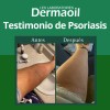 Pomada Natural Para Psoriasis: Hidratación Profunda.