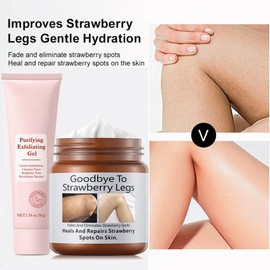 Strawberry Legs Treatment with Purifying Exfoliating Gel,Keratosis Pilaris Cream,Skin Exfoliating Repair Cream,Strawberry Skin Treatment,Moisturizing Body Cream,Rough Bumpy Skin Body Lotion(2PCS)