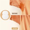 100 Pack Armpit Sweat Pads, Premium Sweat Shield Fight Hyperhidrosis,Disposable