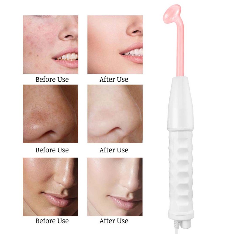 High Frequency Electrode Facial Machine for Skin Body Care Wrinkle