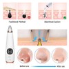ATOMUS ATOMUS Blackhead Remover Tool Kit Skin Care Facial Blackhead