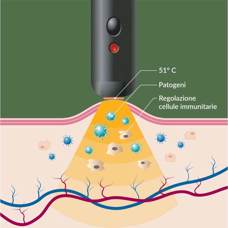 Herpotherm Dispositivo Elettronico Per Il Trattamento Dell'herpes Labiale