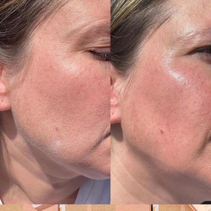 Brandluxe Dermaplaning Refills for Face, Eyebrow Shaping, Gentle Hair Removal