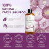 Shampoo De Cebolla Generic Para Crecimiento Capilar