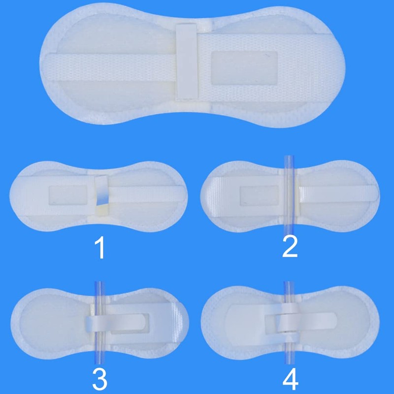 Low-Profile Catheter Stabilization Device for Kids Baby's Gtube Feeding Tube